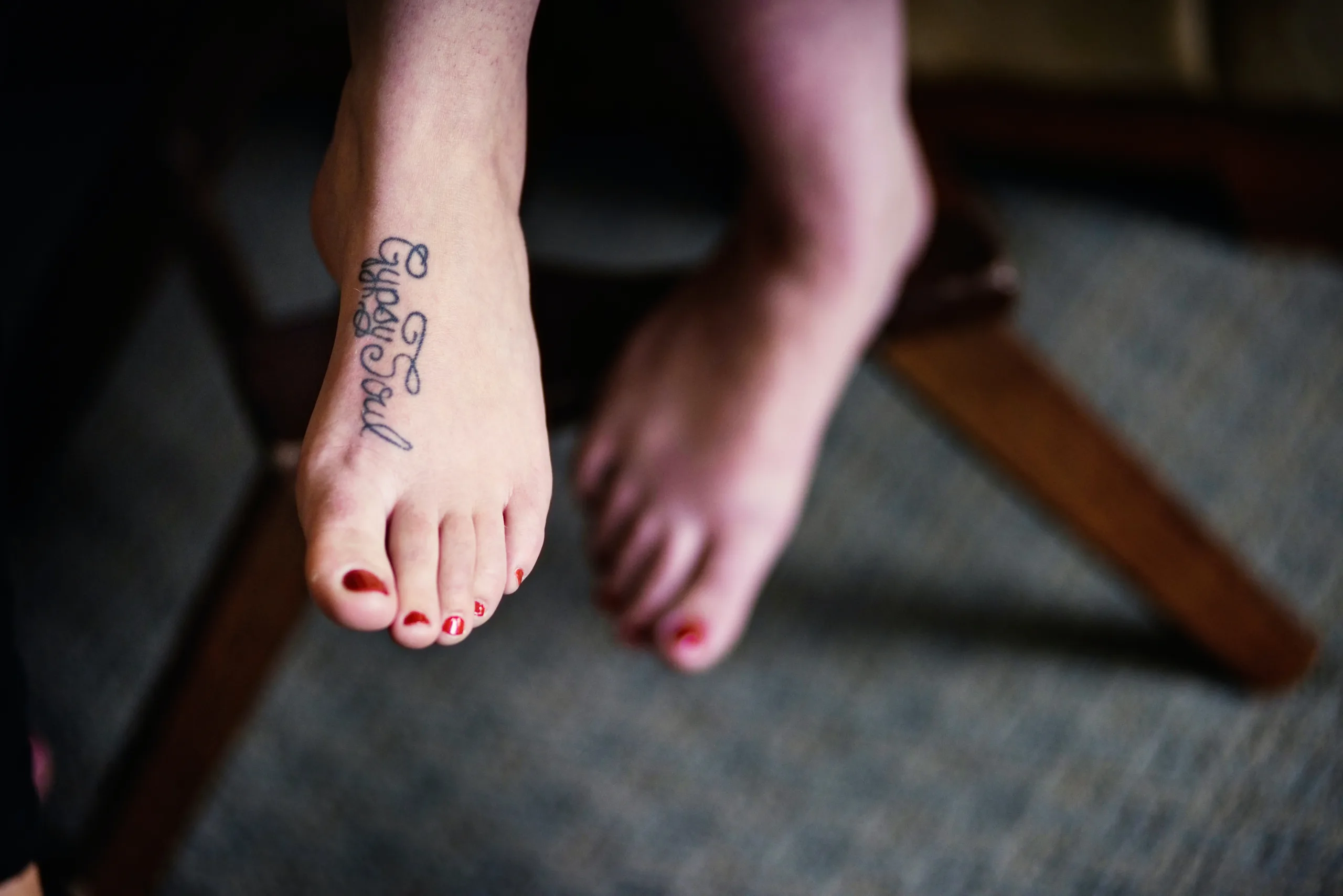 how to know if toenail fungus is dying